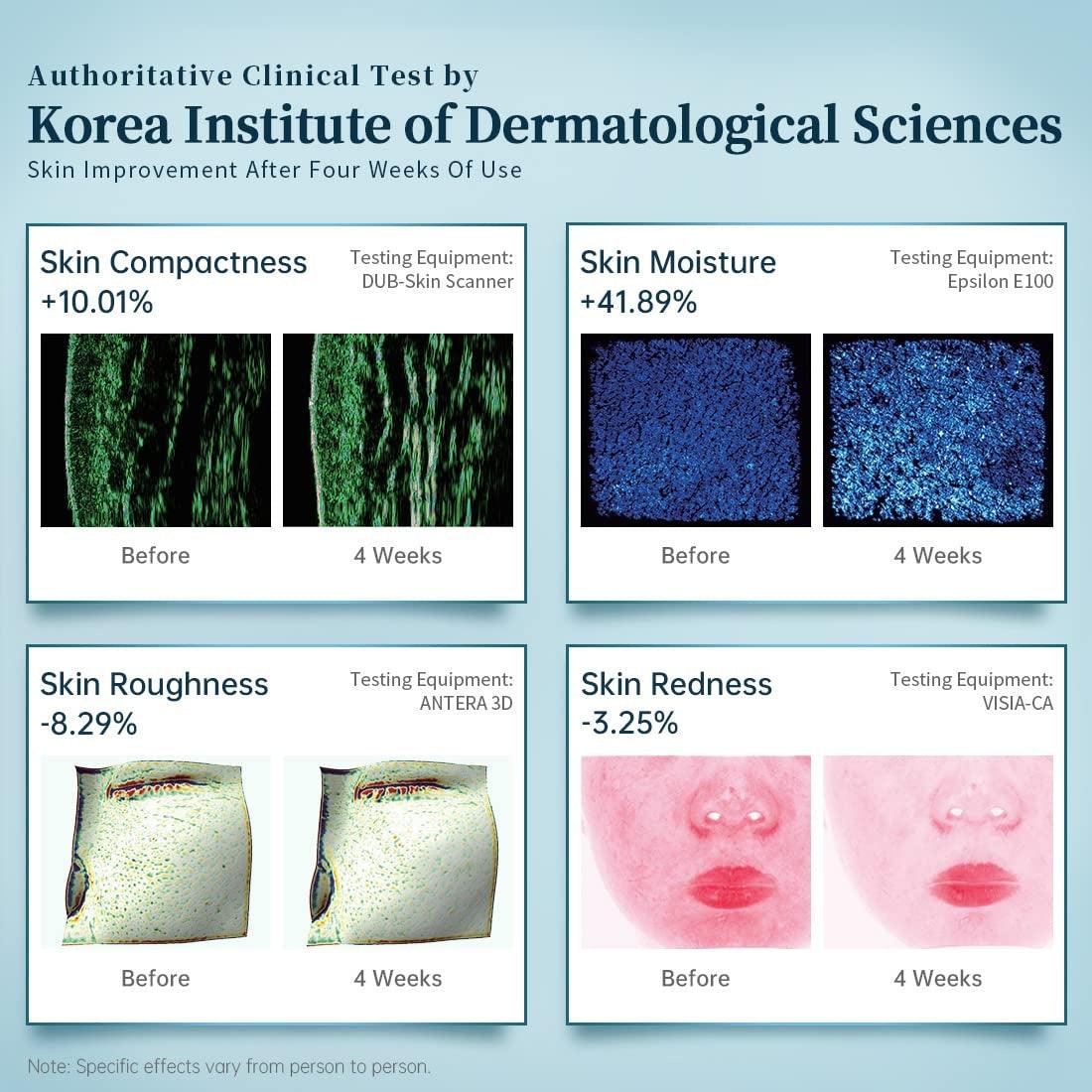 LED Light Therapy Facial Mask - close-up detail