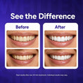 Dent Teeth Whitening Strips, Purple Teeth Whitening Strips, 14 Count Kit